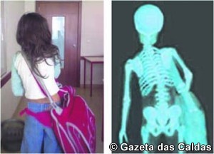 saúde notícias das Caldas