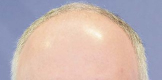 “As observações do público podem ser tidas em conta na decisão final”