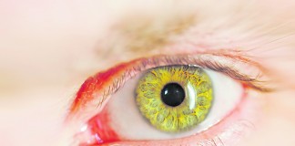 A Retina Noticias das Caldas