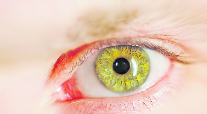 A Retina Noticias das Caldas