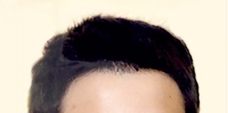 Faleceu Bernardo “Benny” Dourado do Caldas Rugy Clube Noticais das Caldas