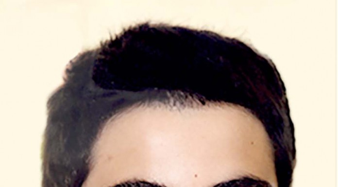 Faleceu Bernardo “Benny” Dourado do Caldas Rugy Clube Noticais das Caldas