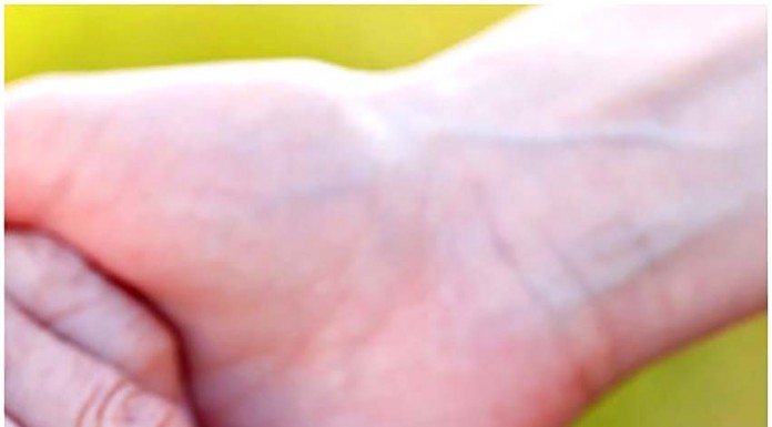 Vendas revertem integralmente para a Alzheimer Portugal Gazeta das Caldas