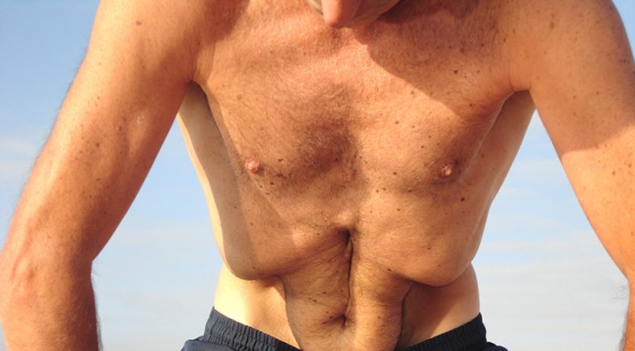 NAULÍ KRIYÁ: Massagem abdominal peristáltica Gazeta das Caldas