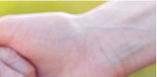 Cuidadores informais à espera de legislação que reconheça o seu estatuto