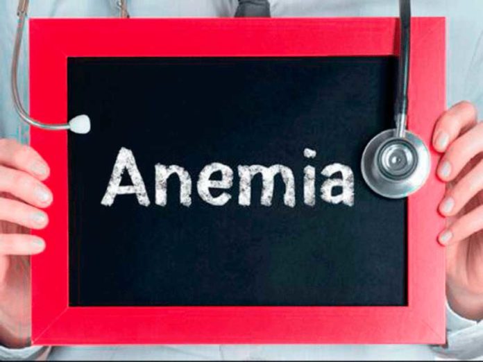 anemia